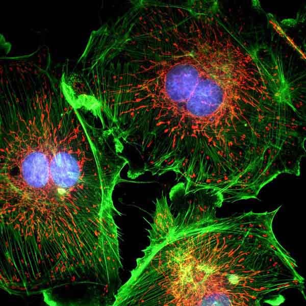 Solutions d'analyse cellulaire