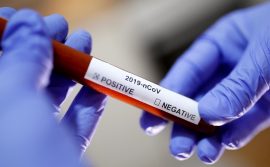 Solutions de recherche en analyse génétique dédiées au SRAS-CoV-2 (COVID-19) Solutions de recherche en analyse génétique dédiées au SRAS-CoV-2 (COVID-19)
